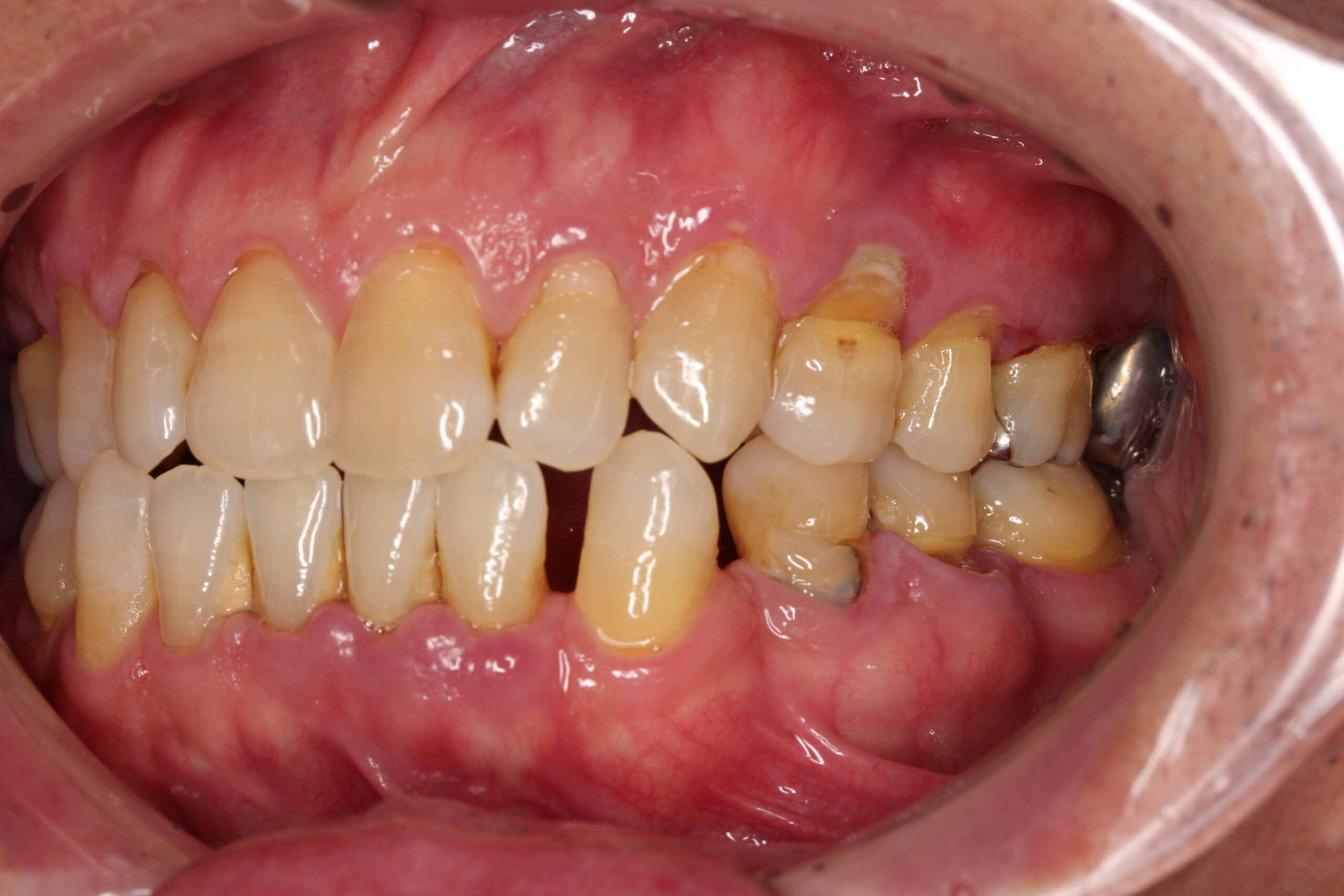 歯周病を意識したことはありますか？